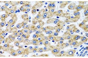 Immunohistochemistry of paraffin-embedded Human liver using SERPINA7 Polyclonal Antibody at dilution of 1:100 (40x lens). (SERPINA7 antibody)