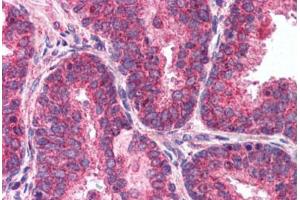 Human Prostate (formalin-fixed, paraffin-embedded) stained with mTOR antibody ABIN214561 at 2. (MTOR antibody  (AA 2440-2457))