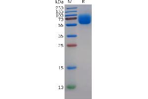 SDS-PAGE (SDS) image for TYRO3 Protein Tyrosine Kinase (TYRO3) (AA 41-428) protein (His tag) (ABIN7092693)