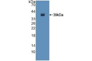 Detection of Recombinant ISR, Human using Polyclonal Antibody to Insulin Receptor (INSR) (Insulin Receptor antibody  (AA 1027-1364))