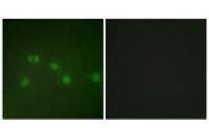 Immunofluorescence analysis of HUVEC cells, using COT2 antibody.