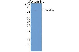 Western Blotting (WB) image for anti-Kallikrein-Related Peptidase 4 (KLK4) (AA 32-255) antibody (ABIN3208604) (Kallikrein 4 antibody  (AA 32-255))