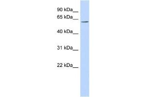 Western Blotting (WB) image for anti-Transmembrane Protein 209 (TMEM209) antibody (ABIN2460092) (TMEM209 antibody)