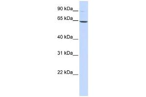 WB Suggested Anti-LTA4H Antibody Titration: 0. (LTA4H antibody  (Middle Region))