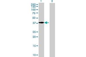 Western Blot analysis of MECR expression in transfected 293T cell line by MECR MaxPab polyclonal antibody.