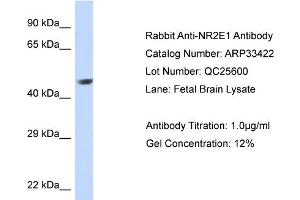 Western Blotting (WB) image for anti-Nuclear Receptor Subfamily 2, Group E, Member 1 (NR2E1) (Middle Region) antibody (ABIN2777931)