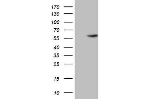 Western Blotting (WB) image for anti-4-Aminobutyrate Aminotransferase (ABAT) (AA 29-323) antibody (ABIN2715601)