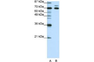 WB Suggested Anti-TRIM16 Antibody Titration:  1. (TRIM16 antibody  (N-Term))