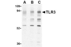 Image no. 1 for anti-Toll-Like Receptor 3 (TLR3) (N-Term) antibody (ABIN265140) (TLR3 antibody  (N-Term))