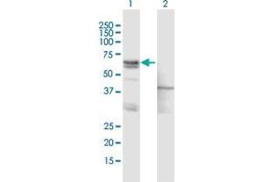 Western Blot analysis of ASNS expression in transfected 293T cell line by ASNS MaxPab polyclonal antibody. (Asparagine Synthetase antibody  (AA 1-561))