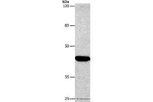 Western blot analysis of Hela cell, using CTGF Polyclonal Antibody at dilution of 1:850