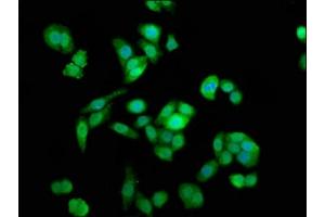 Immunofluorescence staining of PC-3 cells with ABIN7160740 at 1:133, counter-stained with DAPI. (NAA38 antibody  (AA 2-173))