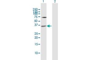 Western Blot analysis of MEOX2 expression in transfected 293T cell line by MEOX2 MaxPab polyclonal antibody. (MEOX2 antibody  (AA 1-303))