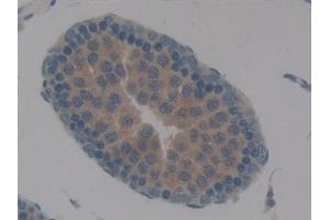 Detection of TBX21 in Rat Testis Tissue using Polyclonal Antibody to T-Box Protein 21 (TBX21) (T-Bet antibody  (AA 241-493))