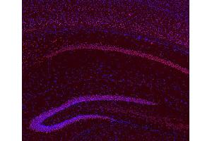 Indirect immunostaining of PFA fixed, paraffin embedded mouse brain section (dilution 1 : 200; red). (BCL11B antibody  (AA 541-812))