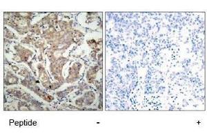 Image no. 1 for anti-BCL2-Associated Agonist of Cell Death (BAD) (Ser155) antibody (ABIN197212)