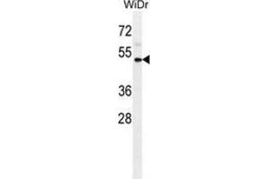 Western blot analysis in WiDr cell line lysates (35ug/lane) using CD121b / IL1R2  Antibody . (IL1R2 antibody  (Middle Region))