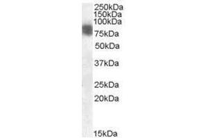 Image no. 1 for anti-Cortactin (CTTN) (N-Term) antibody (ABIN374140) (Cortactin antibody  (N-Term))