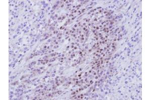 IHC-P Image Immunohistochemical analysis of paraffin-embedded SAS Xenograft , using RBMY1A1, antibody at 1:100 dilution. (RBMY1A1 antibody)