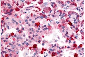 Anti-TRPM4 antibody  ABIN1049433 IHC staining of human pancreas. (TRPM4 antibody  (Internal Region))