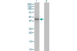 Western Blot analysis of HDAC11 expression in transfected 293T cell line by HDAC11 monoclonal antibody (M01), clone 1C2-2G5. (HDAC11 antibody  (AA 1-347))
