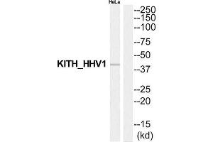 Western Blotting (WB) image for anti-Thymidine Kinase 1, Soluble (TK1) (Internal Region) antibody (ABIN1852520)