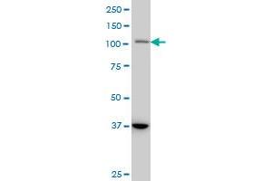 STAT2 monoclonal antibody (M01), clone 5G7 Western Blot analysis of STAT2 expression in A-431 . (STAT2 antibody  (AA 742-851))