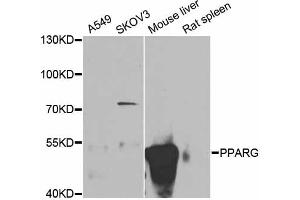 Western blot analysis of extracts of various cell lines, using PPARG antibody (ABIN5998576) at 1/1000 dilution. (PPARG antibody)