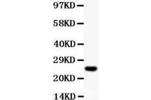 Anti-Cyclin D3 Picoband antibody,  All lanes: Anti Cyclin D3  at 0. (Cyclin D3 antibody  (AA 136-292))