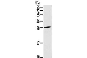 Western Blot analysis of Human fetal muscle tissue using THYN1 Polyclonal Antibody at dilution of 1/800 (THYN1 antibody)