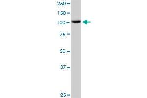 CDH1 MaxPab rabbit polyclonal antibody. (E-cadherin antibody  (AA 1-882))