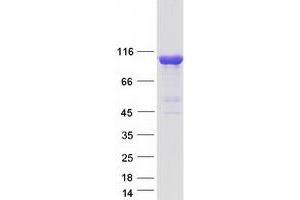 Validation with Western Blot (INPP4A Protein (Transcript Variant B) (Myc-DYKDDDDK Tag))