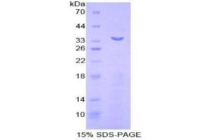 SDS-PAGE analysis of Mouse Matrix Metalloproteinase 7 (MMP7) Protein. (MMP7 Protein)