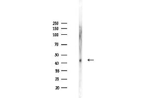 anti-Branched Chain Keto Acid Dehydrogenase E1, alpha Polypeptide (BCKDHA) (Internal Region) antibody