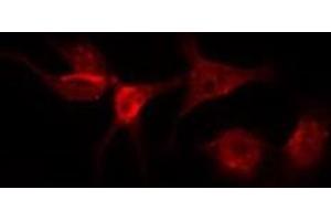 ABIN6275972 staining Hela by IF/ICC. (Angiotensin II Type-1 Receptor antibody  (N-Term))