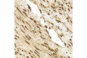 Immunohistochemistry of paraffin-embedded human leiomyoma of uterus using ANP32A Antibody. (PHAP1 antibody  (AA 1-170))