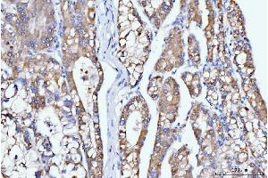 IHC analysis of DHODH using anti-DHODH antibody (ABIN7603139).