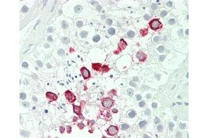 Formalin-fixed and paraffin-embedded H. (IFNA4 antibody  (C-Term))