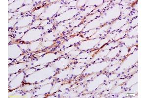 Formalin-fixed and paraffin embedded rat kidney tissue labeled with Anti-ENaCg/γENaC Polyclonal Antibody, Unconjugated at 1:200 followed by conjugation to the secondary antibody and DAB staining (SCNN1G antibody  (AA 188-290))