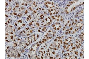 Immunoperoxidase of monoclonal antibody to WWP1 on formalin-fixed paraffin-embedded human stomach. (WWP1 antibody  (AA 152-260))