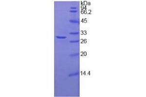 SDS-PAGE analysis of Human Fucosyltransferase 4 Protein. (CD15 Protein)