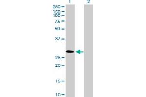 Western Blot analysis of CMTM2 expression in transfected 293T cell line by CMTM2 MaxPab polyclonal antibody. (CMTM2 antibody  (AA 1-248))