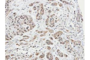 IHC-P Image Immunohistochemical analysis of paraffin-embedded A549 xenograft, using ARPC1A, antibody at 1:100 dilution. (ARPC1A antibody  (N-Term))