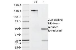 SDS-PAGE Analysis Purified Granzyme B Mouse Monoclonal Antibody (GZMB/2403). (GZMB antibody  (AA 73-187))