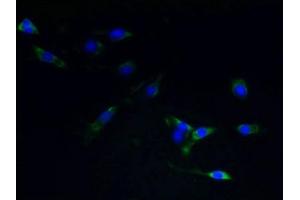 Immunofluorescent analysis of NIH/3T3 cells using ABIN7170878 at dilution of 1:100 and Alexa Fluor 488-congugated AffiniPure Goat Anti-Rabbit IgG(H+L) (TACR1 antibody  (AA 1-29))
