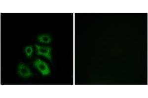 Immunofluorescence analysis of A549 cells, using CLIP3 Antibody. (CLIP3 antibody  (AA 361-410))
