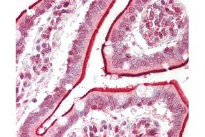 Human Small Intestine: Formalin-Fixed, Paraffin-Embedded (FFPE). (DHRS12 antibody  (AA 173-222))