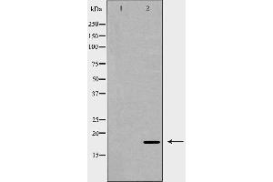 Western blot analysis of SOD1 expression in Jurkat cells,The lane on the left is treated with the antigen-specific peptide. (SOD1 antibody  (Internal Region))