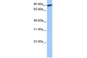 WB Suggested Anti-WDFY3 Antibody Titration:  0. (WDFY3 antibody  (C-Term))