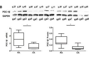 Expression of peroxisome proliferator-activated receptor-gamma coactivator-1 β (PGC-1β) is over-expressed in rheumatoid arthritis (RA)-fibrolast-like synoviocytes (FLS).